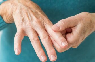 Артрит: докладний огляд причин, симптомів та методів лікування
