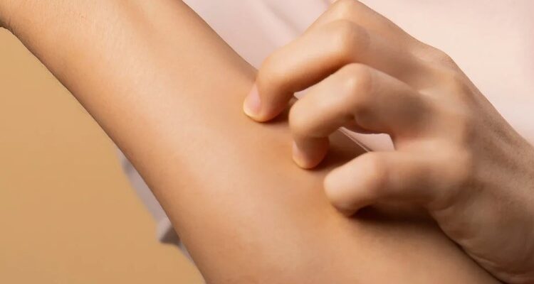 Екзема: Причини, симптоми та методи ефективного лікування стану