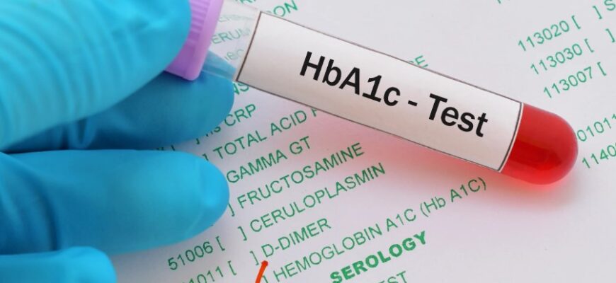 Глікований гемоглобін: що це таке і чому він важливий для здоров’я?