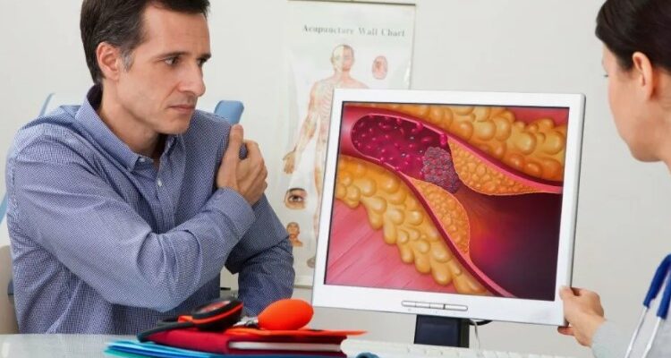 Коефіцієнт атерогенності: визначення, значення та чому це важливо для вас