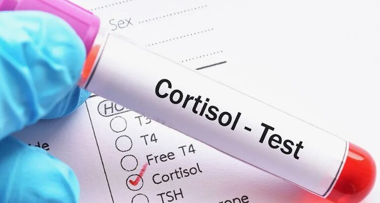 Що таке кортизол: вплив гормону стресу на ваше здоров’я