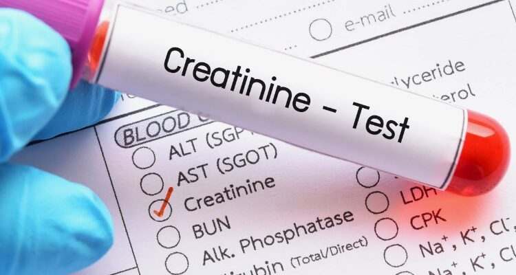Креатинін: Що це таке, його роль в організмі та норма показників
