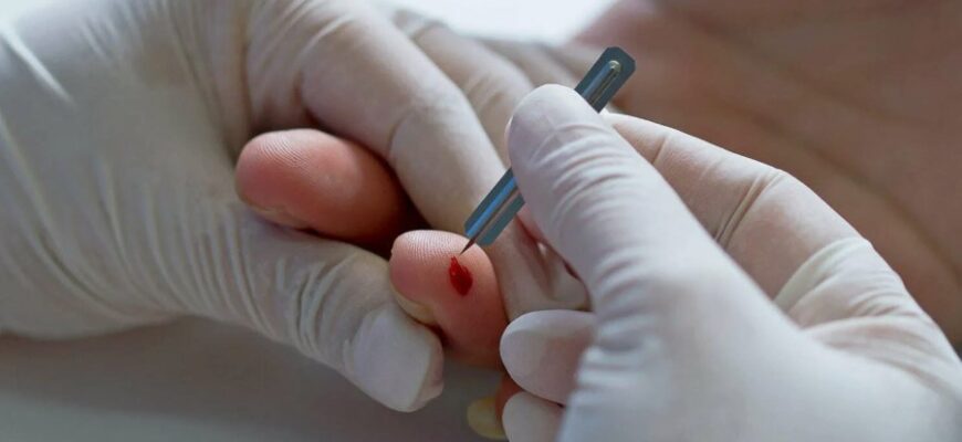 Що таке ланцет: визначення, призначення та сфери використання