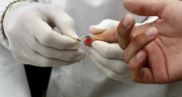 Ліпідограма: що це, навіщо потрібна і як правильно розшифрувати?