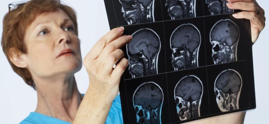 Менінгіт: Симптоми, причини та профілактика небезпечного захворювання