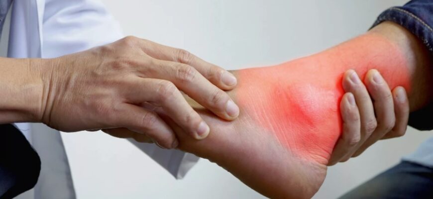 Подагра: Причини, симптоми та ефективні методи лікування захворювання