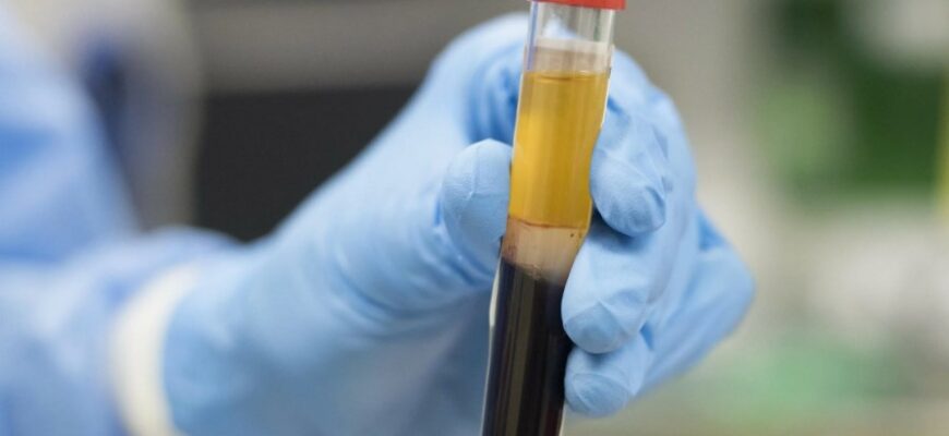 Значення та роль сироватки крові: основні функції та застосування