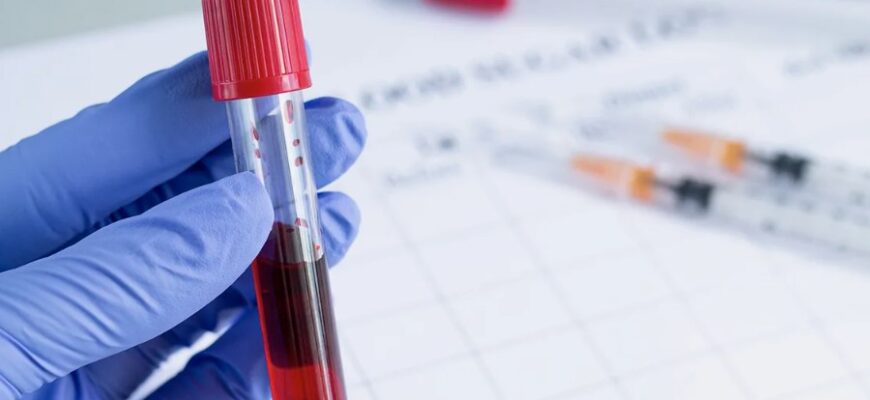 Що таке тромбокрит: важливість та значення показника для здоров’я