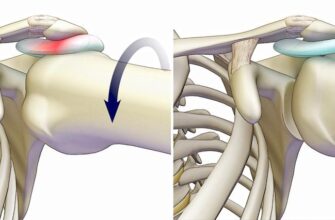 Імпіджмент-синдром: Симптоми, діагностика та ефективні методи лікування