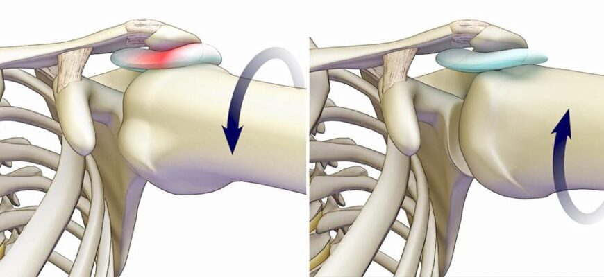 Імпіджмент-синдром: Симптоми, діагностика та ефективні методи лікування