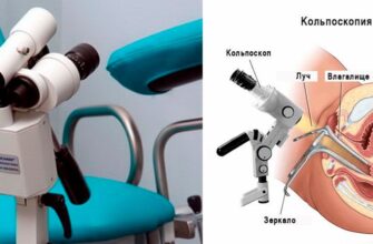 Відеокольпоскопія: сучасний метод діагностики жіночого здоров’я