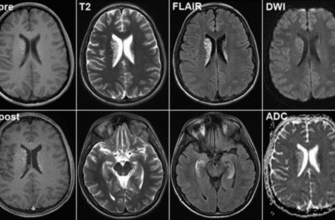 МРТ з контрастом і без: ключові відмінності та переваги
