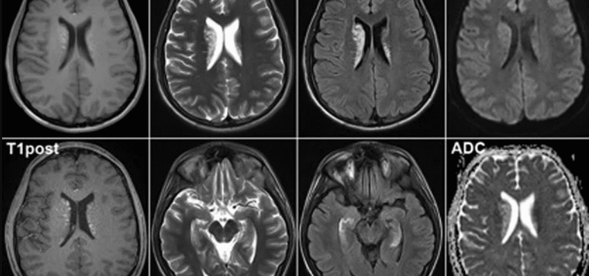МРТ з контрастом і без: ключові відмінності та переваги