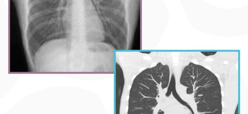 Різниця між рентгенографією та рентгеноскопією: що обрати?