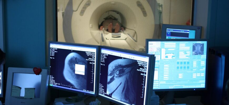 Ехоенцефалографія: що це таке та як проходить процедура діагностики