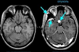Порівняння КТ з контрастом і без: яка різниця в діагностиці?