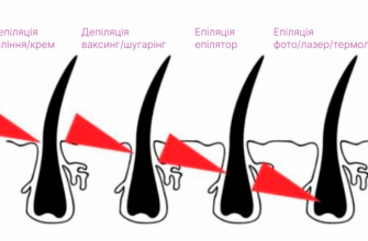 Епіляція vs Депіляція: Основні Відмінності та Що Обрати?