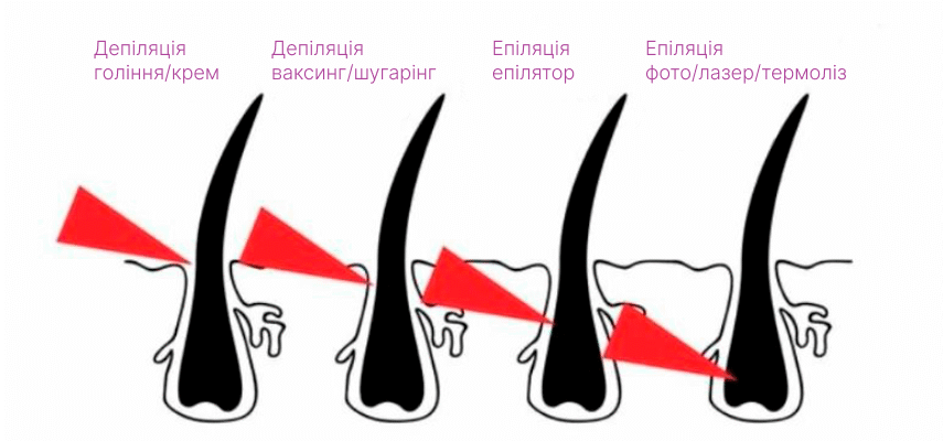 Епіляція vs Депіляція: Основні Відмінності та Що Обрати?