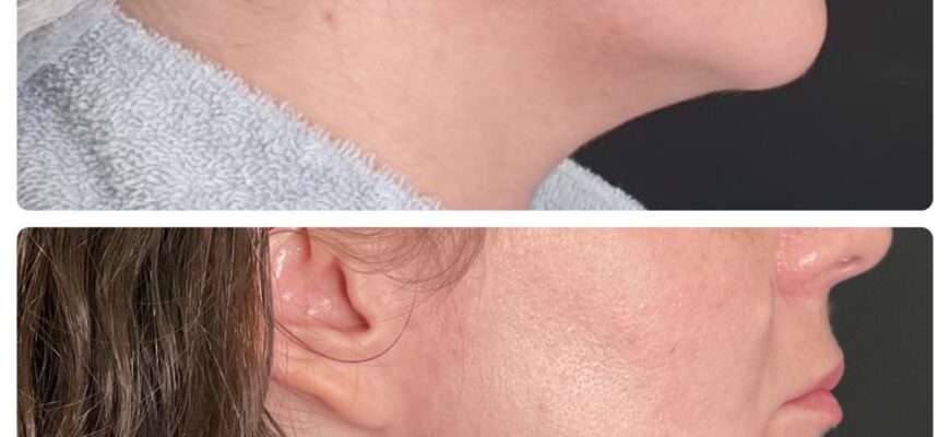 Морфеус: значення та вплив на сучасну культуру і науку