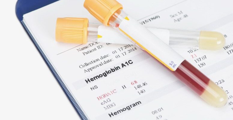 Глікований гемоглобін: ключова інформація та норми для здоров’я крові