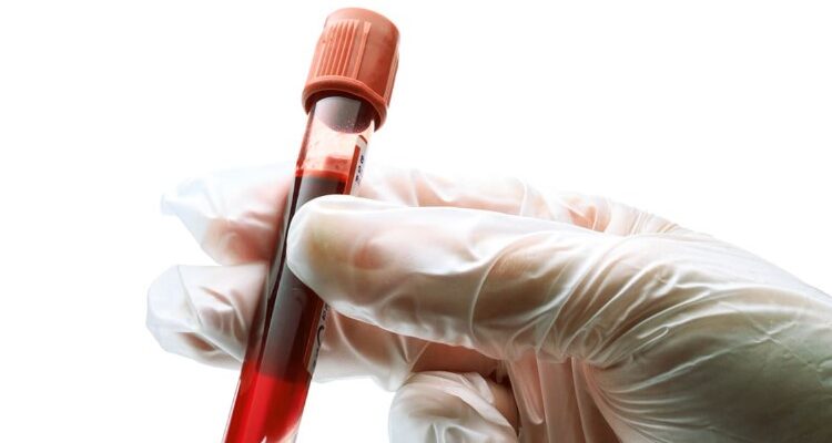 Група крові: Важливість і вплив на здоров’я та сумісність людей