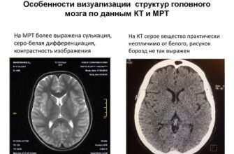 МРТ і КТ: ключові відмінності та особливості діагностики