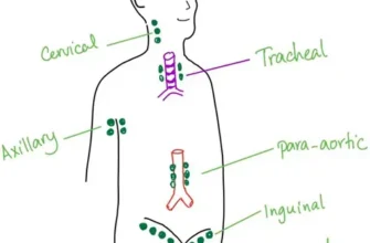 Що таке лімфома: основні види, симптоми та діагностика хвороби