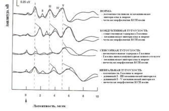 КСВП: Що таке корпоративна соціальна відповідальність підприємств?