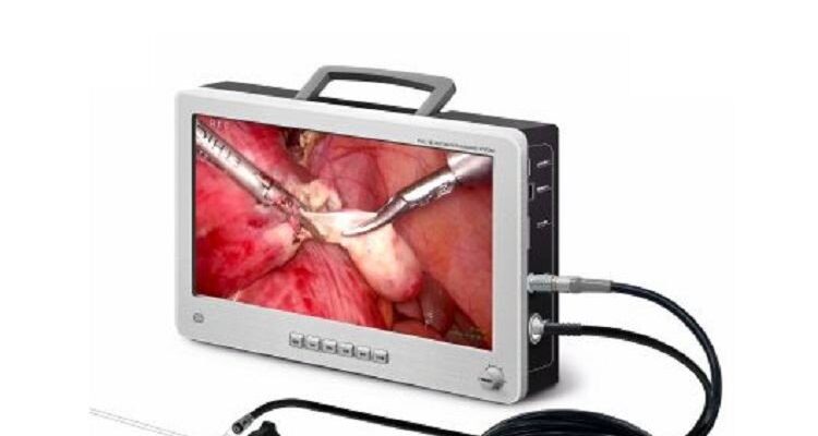 Ендоскопія і гастроскопія: в чому різниця та що важливо знати?