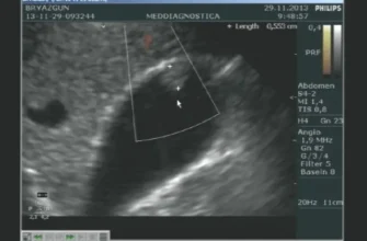 УЗД органів черевної порожнини: докладний огляд і переваги процедури