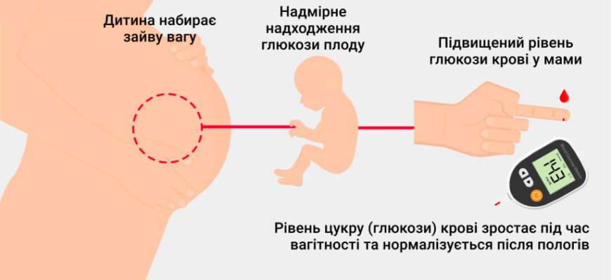 Причини, симптоми та лікування діабету: все, що потрібно знати