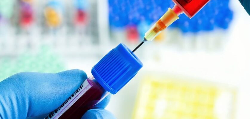 Коефіцієнт атерогенності: розуміння впливу на здоров’я серця