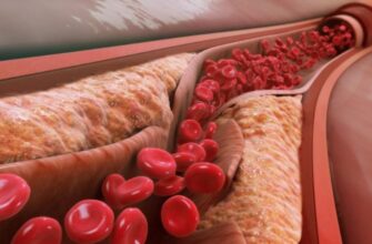 Коефіцієнт атерогенності: значення, розрахунок та вплив на здоров’я