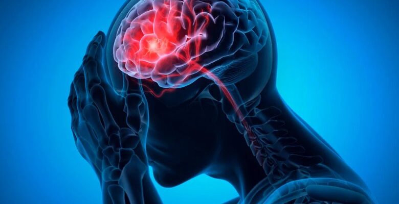 Що таке мікроінсульт і наскільки серйозним є його вплив на здоров’я?