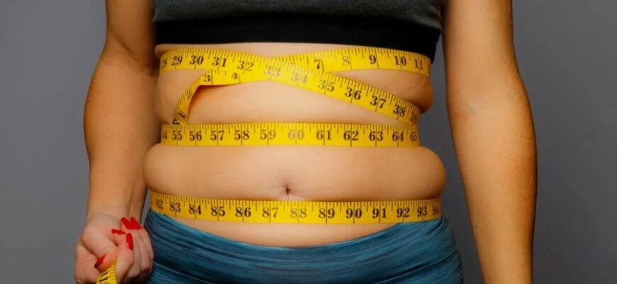 Морбідне ожиріння: причини, ризики та методи боротьби з хворобою