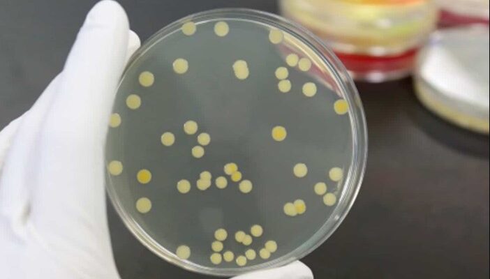 Невидимий ворог: загрози золотистого стафілокока для здоров’я людини