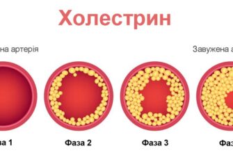 Що таке холестерин в крові: функції, норми та вплив на здоров’я