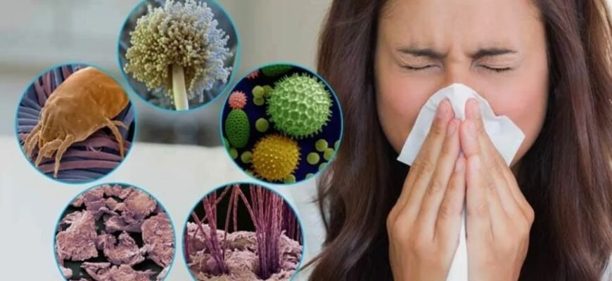 Алергія: Визначення, Причини та Ефективні Способи Лікування