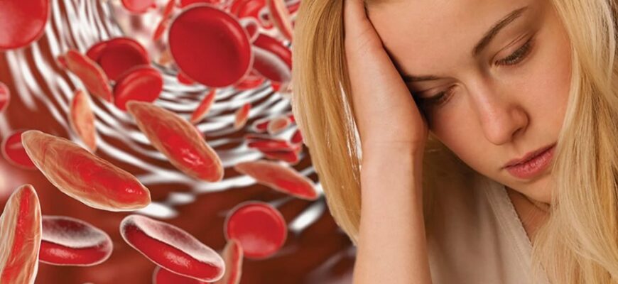 Що таке анемія у дорослих: причини, симптоми та лікування