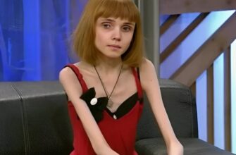 Причини, симптоми та наслідки анорексії: що потрібно знати кожному