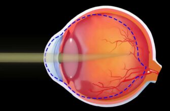 Астигматизм ока: причини, симптоми та методи корекції зору