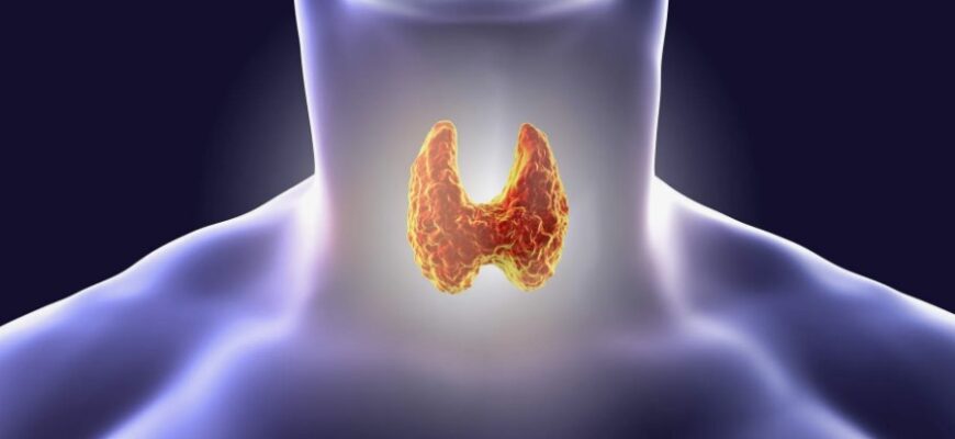 Базедова хвороба: причини, симптоми та методи лікування захворювання
