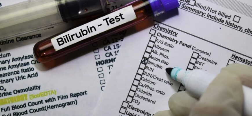 Білірубін: Що Це Таке Та Чому Його Рівень Важливий Для Здоров’я