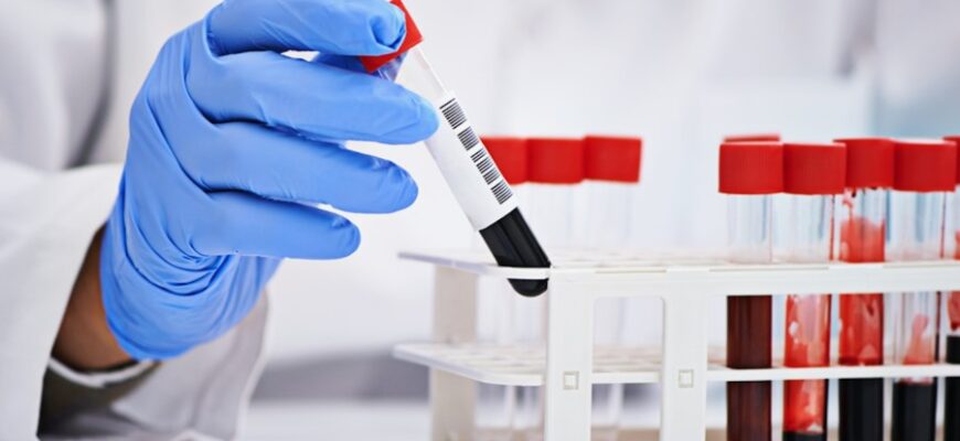 Біохімічний аналіз крові: що це таке і для чого його проводять?