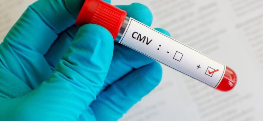 Цитомегаловірус: симптоми, шляхи передачі та методи профілактики