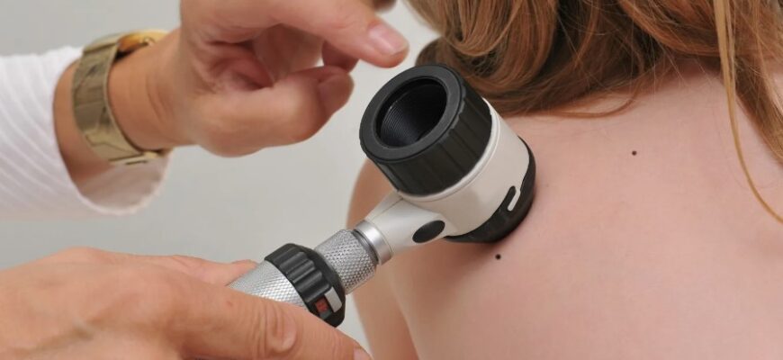 Дерматоскопія: Основи, Переваги та Процедура Обстеження Шкіри