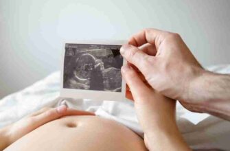 Що таке доплер: принцип дії та застосування у різних сферах