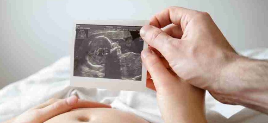 Що таке доплер: принцип дії та застосування у різних сферах