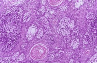 Фібрин: ключ до зупинки кровотечі та загоєння ран