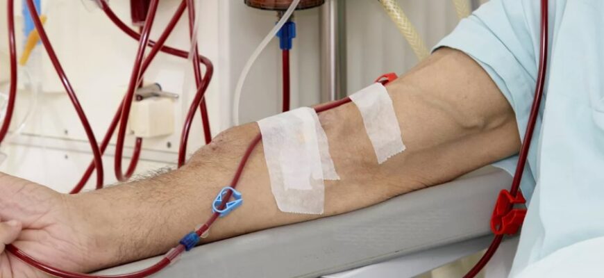 Гемодіаліз: що це таке, процес процедури та її переваги
